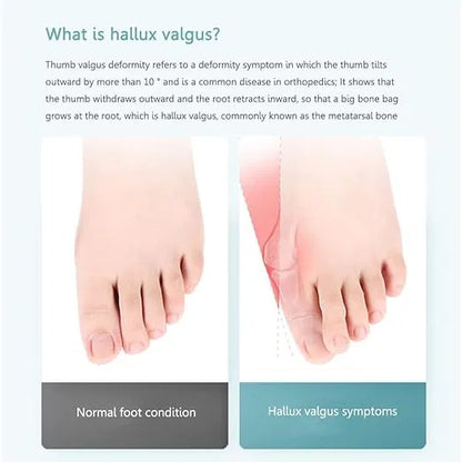 Adjustable Toe Straightener for Men & Women